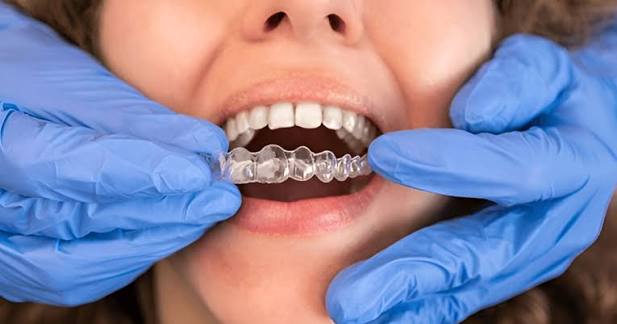 Invisalign provider in Encino