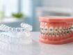 Invisalign dentist Encino